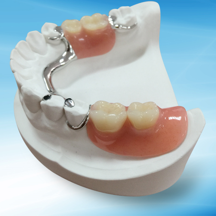 Natural Metal Frame Partial Denture